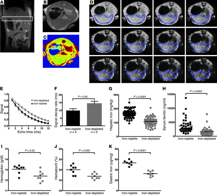 Dietary iron depletion results in decreased hepatic iron, serum ferritin...