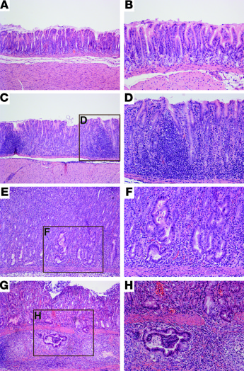 Wild-type H. pylori strain 7.13 induces gastric inflammation, dysplasia,...