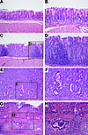 Wild-type H. pylori strain 7.13 induces gastric inflammation, dysplasia, an