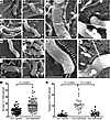 Exposure of H. pylori to iron-depleted conditions in vivo and in vitro augm