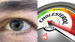 High Cholesterol Warning This Colourful Facial Symptom Should Not Be Ignored High Cholesterol Warning This Colourful Facial Symptom Should Not Be Ignored