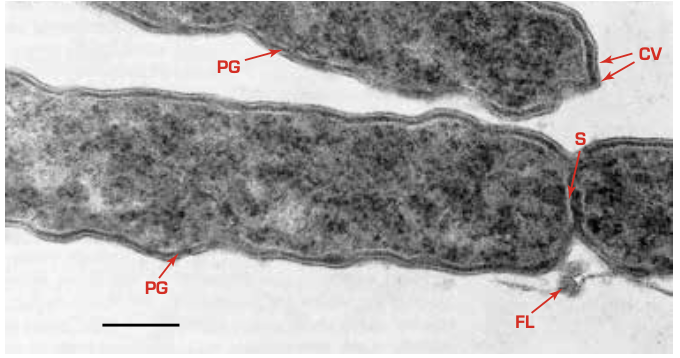 Helicobacter pylori