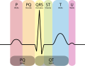 Strecken, Intervalle und Komplexe im EKG