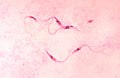 Trypanosoma cruzi (Chagas-Krankheit)