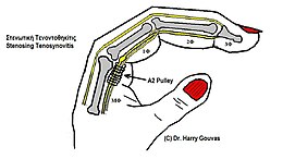 Description de l'image Tenontothikitis deiktou.jpg.