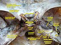 Tympanic cavity. Facial canal. Internal carotid artery.