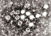 An electron micrograph of parvovirus B19 in blood.