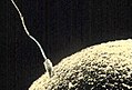 Spermatozoïde fécondant l'ovule