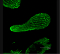 β-tubulina en Tetrahymena, (un protozoo ciliado).