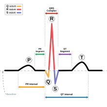 SinusRhythmLabels.svg