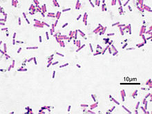 Bacillus subtilis, Gram stained