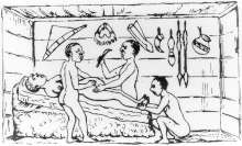 Successful Cesarean section performed by indigenous healers in Kahura, Uganda. As observed by R. W. Felkin in 1879.