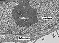 Un nucleolo visto al microscopio elettronico a trasmissione